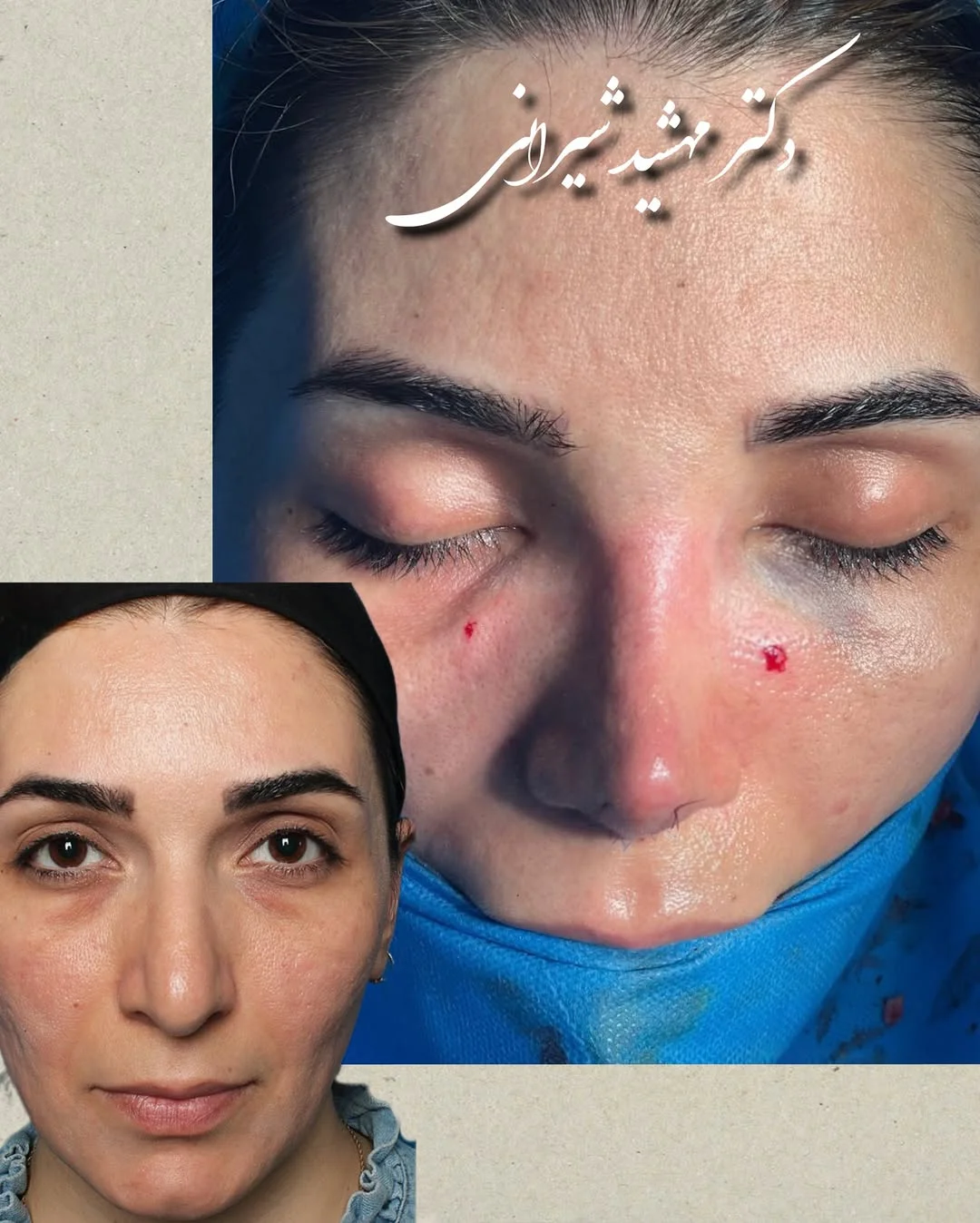 دکتر مهشید شیرانی | جراح بینی